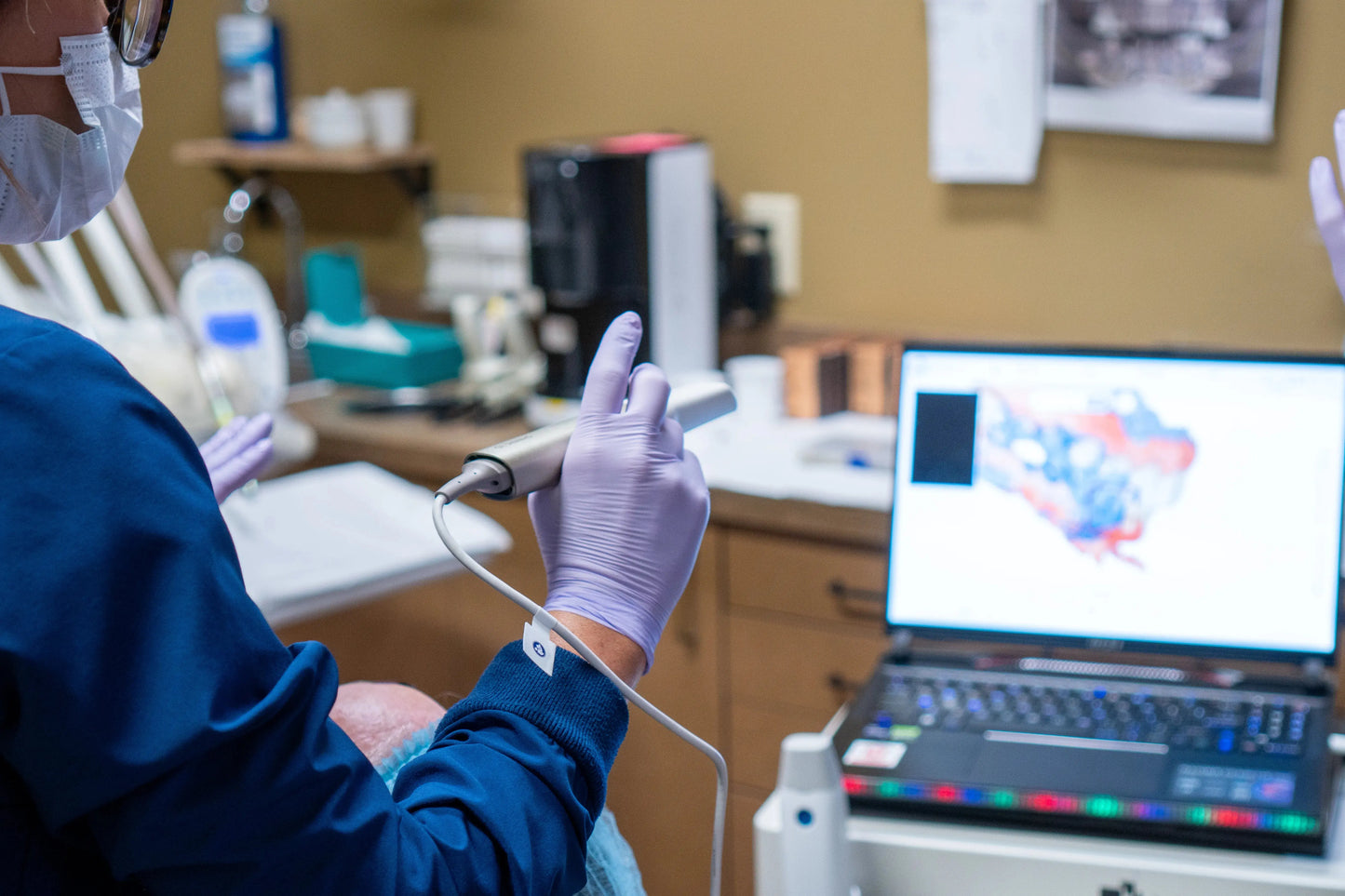 Online Training for Aoralscan Series (Intraoral Scanner) Shining 3D Technology Inc.